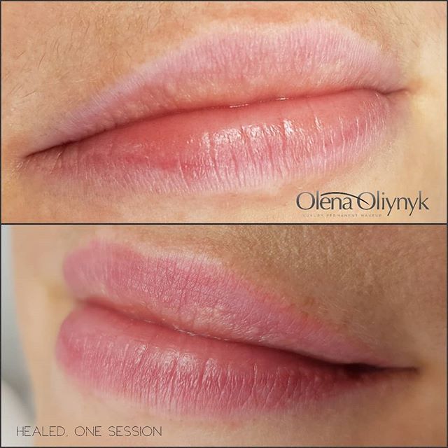 PMU for Lips - The better Alternative