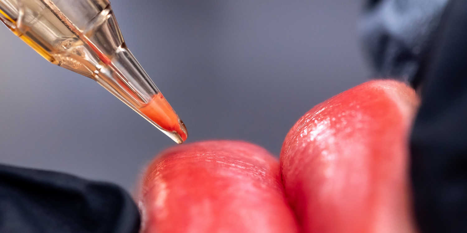 PMU Needle Depth Explained: Finding the Sweet Spot for Better Healed Results