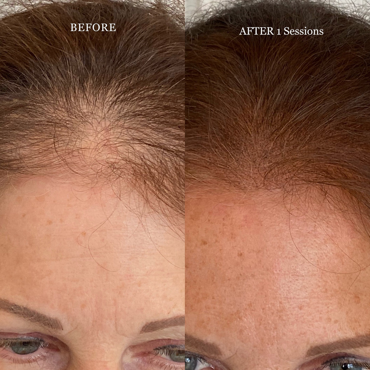 Scalp Micro Dark Brown — Perma Blend - Microbeau International Scalp Micro Dark Brown — Perma Blend