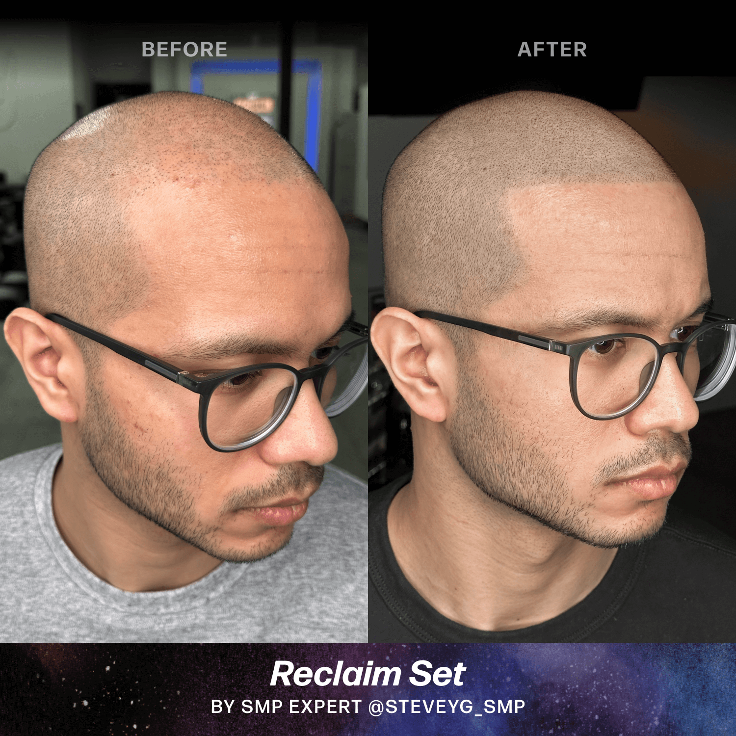 LUXE Reclaim Set by Sculpted – Stevey G - Microbeau InternationalLUXE Reclaim Set by Sculpted – Stevey G