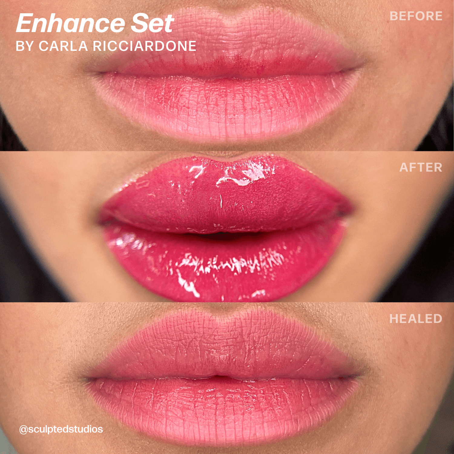 LUXE Enhance Set by Sculpted – Carla Ricciardone - Microbeau InternationalLUXE Enhance Set by Sculpted – Carla Ricciardone