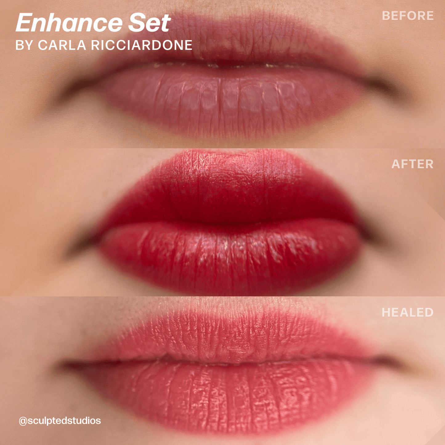LUXE Enhance Set by Sculpted – Carla Ricciardone - Microbeau International LUXE Enhance Set by Sculpted – Carla Ricciardone