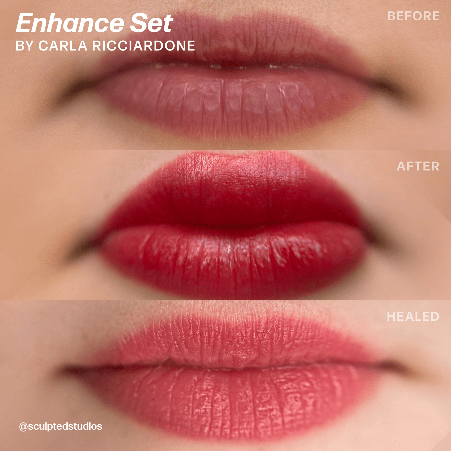 LUXE Enhance Set by Sculpted – Carla Ricciardone - Microbeau InternationalLUXE Enhance Set by Sculpted – Carla Ricciardone
