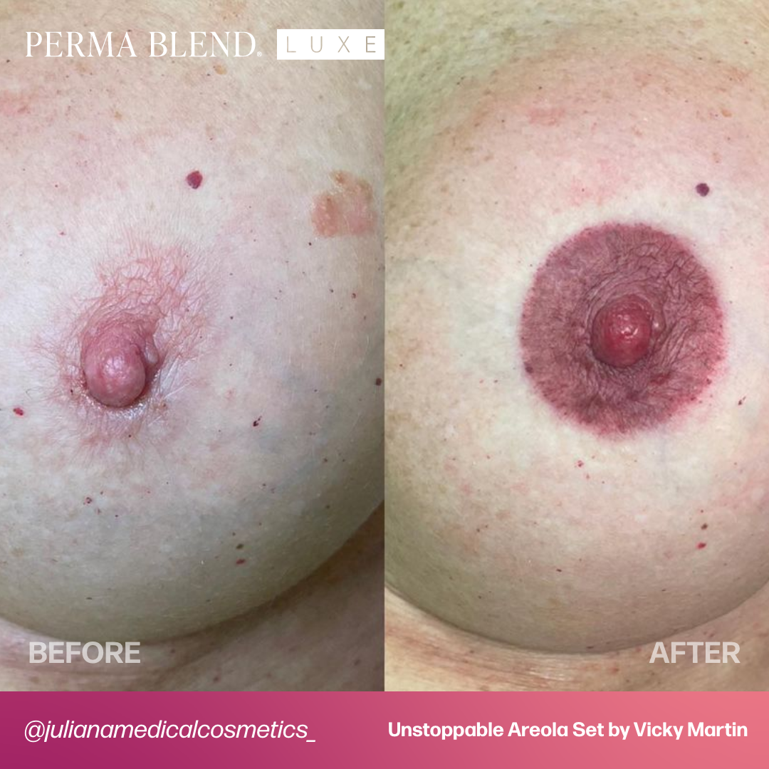 LUXE Unstoppable Areola Set by Vicky Martin Areola - Microbeau InternationalLUXE Unstoppable Areola Set by Vicky Martin Areola