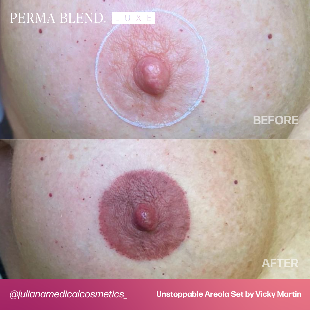 LUXE Unstoppable Areola Set by Vicky Martin Areola - Microbeau InternationalLUXE Unstoppable Areola Set by Vicky Martin Areola