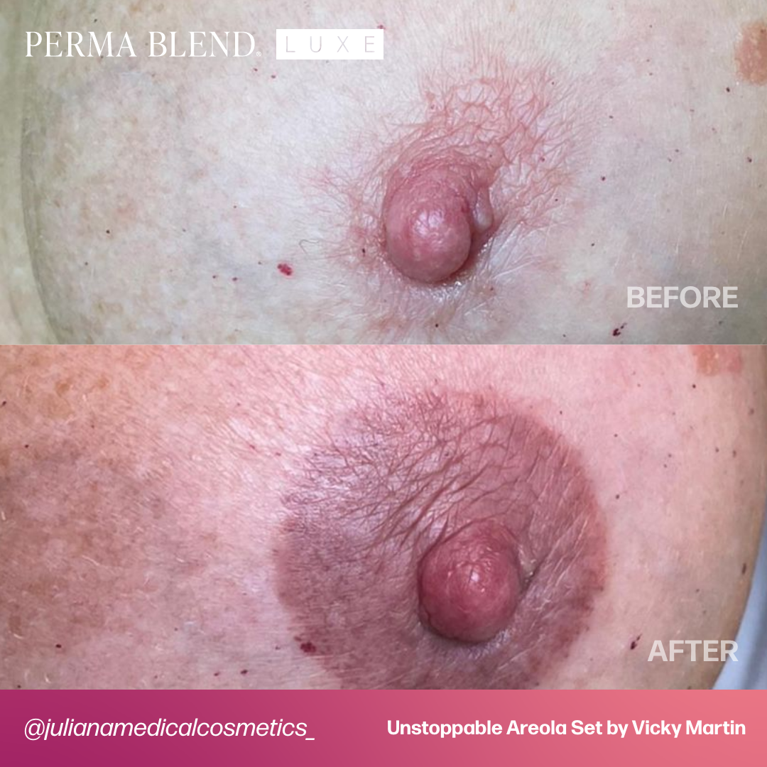 LUXE Unstoppable Areola Set by Vicky Martin Areola - Microbeau International LUXE Unstoppable Areola Set by Vicky Martin Areola