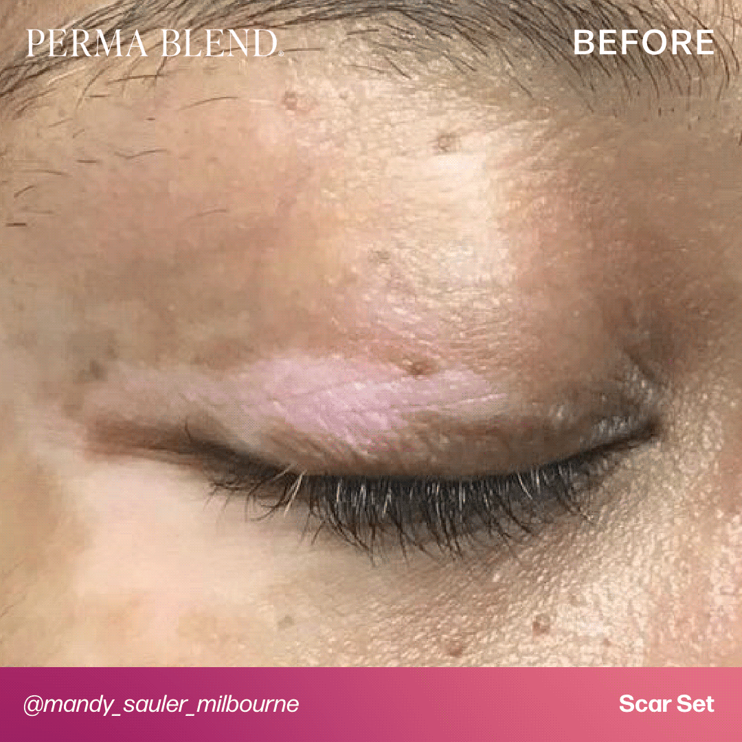 Mandy Sauler Scar Set — Perma Blend — 6 1/2oz Bottles