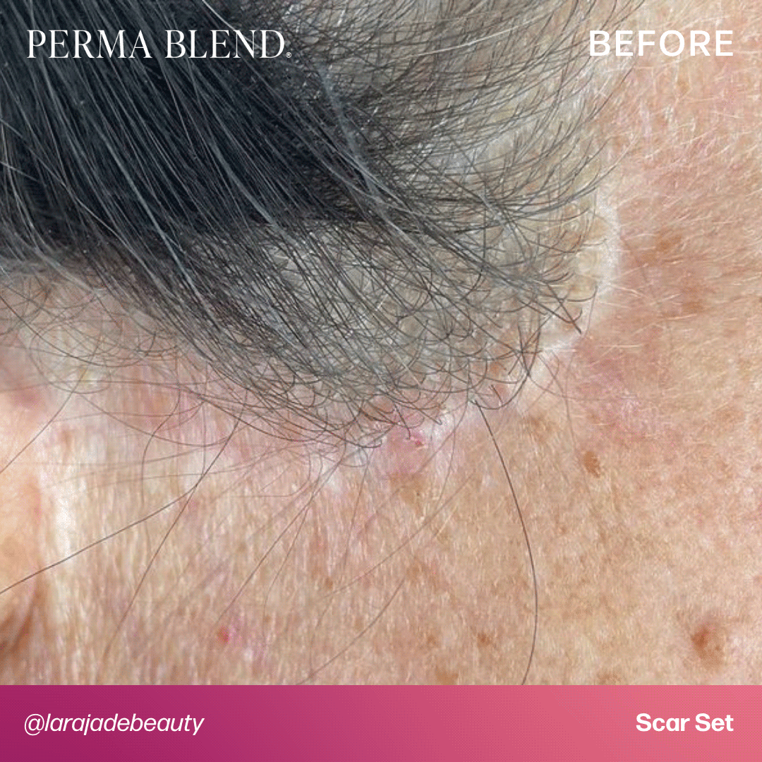 Mandy Sauler Scar Set — Perma Blend — 6 1/2oz Bottles