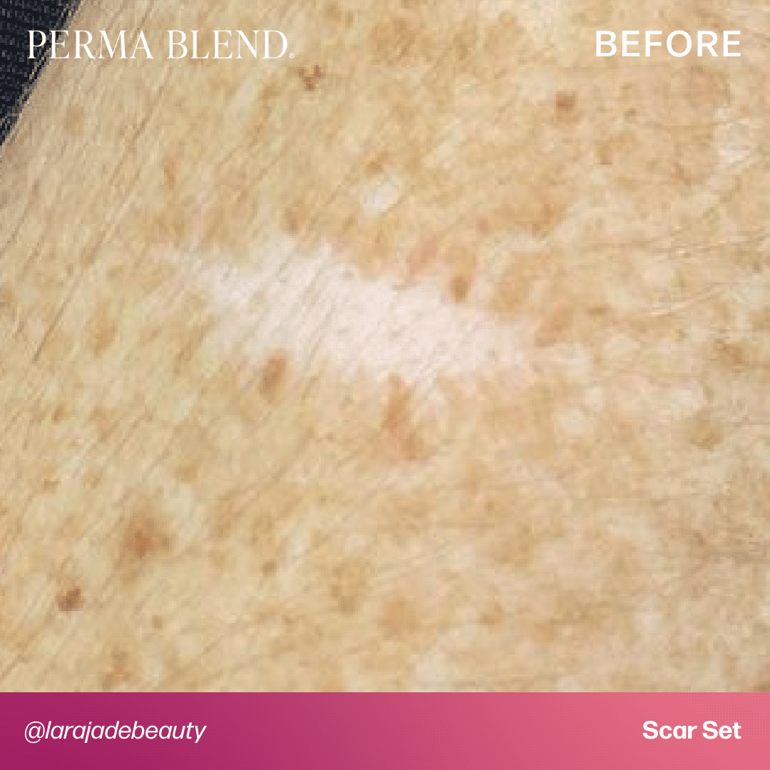 Mandy Sauler Scar Set — Perma Blend — 6 1/2oz Bottles