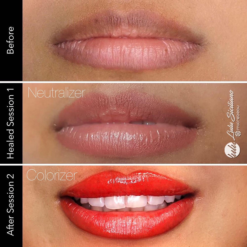 evenflo true lips Evenflo Neutralizer Set